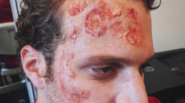 MorbidMark