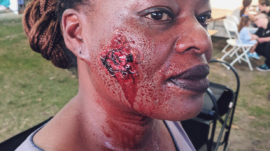 ZombieInjury