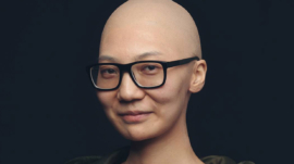bald