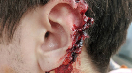 zombie-feature-wound