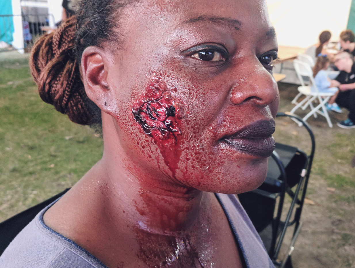 ZombieInjury