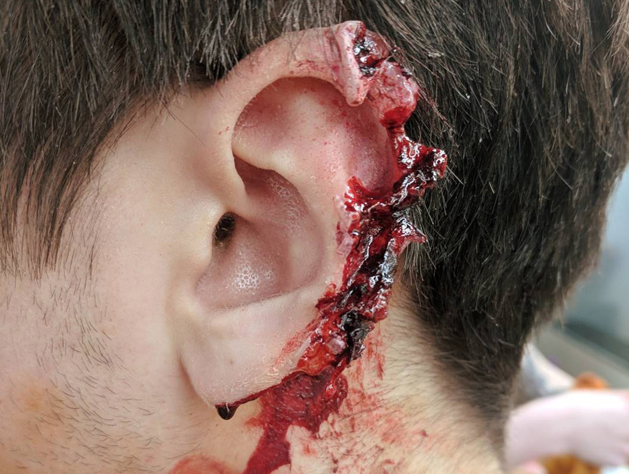 zombie-feature-wound
